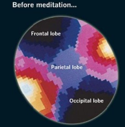 польза медитации-1