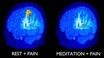 медитация и боль